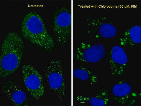 ANTI-LC3 (APG8B) (N-TERM) antibody produced in rabbit purified immunoglobulin, buffered aqueous solution