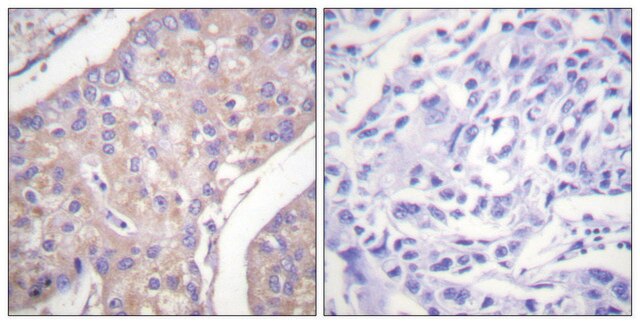 Anti-GAB1 antibody produced in rabbit affinity isolated antibody