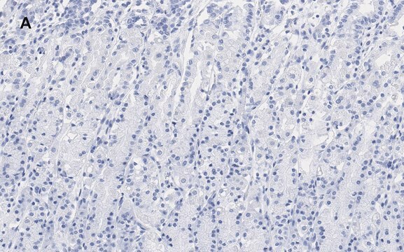 Anti-IKB &#945; Antibody, clone 6O8, ZooMAb&#174; Rabbit Monoclonal recombinant, expressed in HEK 293 cells