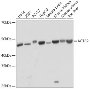 Anti-AGTR2 Antibody, clone 0V7Y3, Rabbit Monoclonal