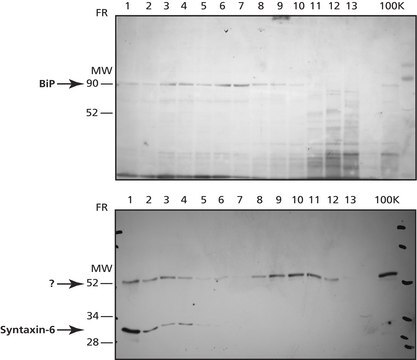 Isolierungskit für das endoplasmatische Retikulum isolation of intact ER from mammalian soft tissues and cultured cells