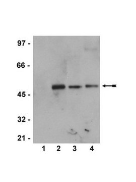 Anti-phospho-MEK1 (Ser218/222)/MEK2 (Ser222/226) Antibody, rabbit monoclonal Upstate&#174;, from rabbit