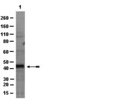 Anti-HDAC11 Antibody from rabbit