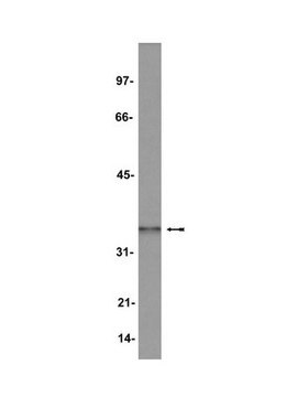 Anti-Hox A9 Antibody Upstate&#174;, from rabbit