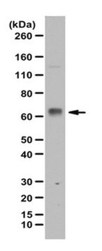 Anti-phospho NFkB p65 Antibody, (Ser547) from rabbit, purified by affinity chromatography