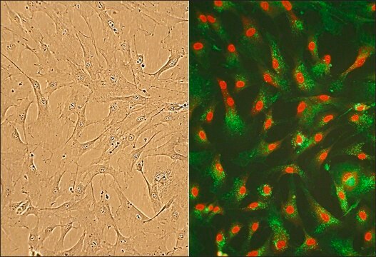 Human Cardiac Fibroblasts: HCF, fetal