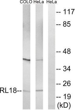 Anti-RPL18 antibody produced in rabbit affinity isolated antibody