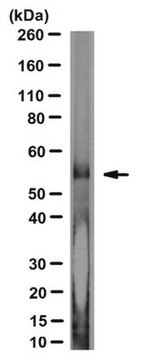 Anti-C9ORF72/C9RANT (poly-AP) Antibody, clone 14E2 clone 14E2, from rat