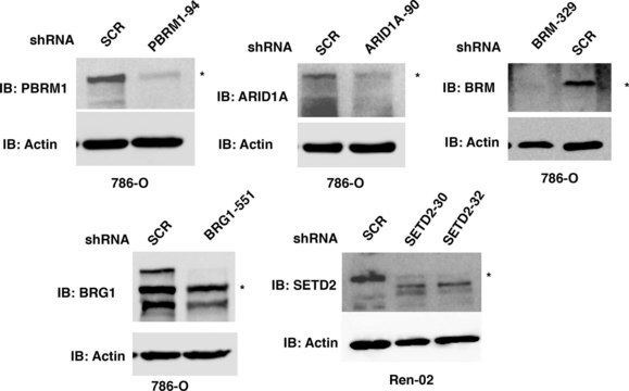 Anti-SMARCA2 antibody produced in rabbit Prestige Antibodies&#174; Powered by Atlas Antibodies, affinity isolated antibody, buffered aqueous glycerol solution