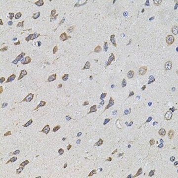 Anti-FoxO3a antibody produced in rabbit