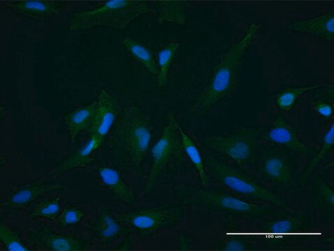 Anti-SETBP1 antibody produced in mouse purified immunoglobulin, buffered aqueous solution