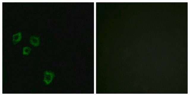 Anti-MUC16 antibody produced in rabbit affinity isolated antibody