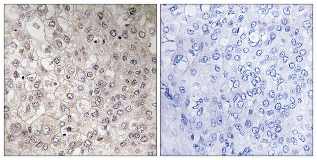 Anti-GIPR antibody produced in rabbit affinity isolated antibody