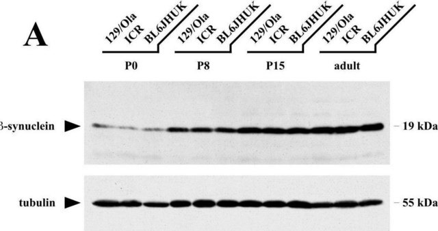 Monoklonaler Anti-&#945;-Tubulin-Antikörper in Maus hergestellte Antikörper clone DM1A, ascites fluid