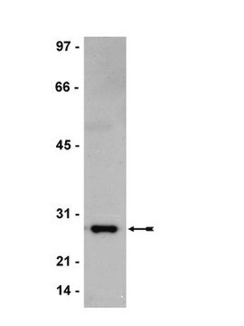 Anti-Bcl-2 Antibody, clone AW604 clone AW604, Upstate&#174;, from mouse