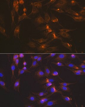 Anti-GLUT2/SLC2A2 antibody produced in rabbit