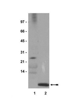 Anti-Ubiquitin-Antikörper Upstate&#174;, from rabbit