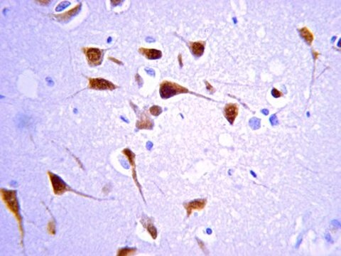 Anti-Cholinacetyltransferase (ChAT)-Antikörper serum, Chemicon&#174;