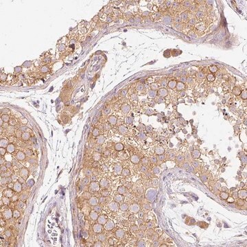 Anti-RNF167 antibody produced in rabbit Prestige Antibodies&#174; Powered by Atlas Antibodies, affinity isolated antibody, buffered aqueous glycerol solution