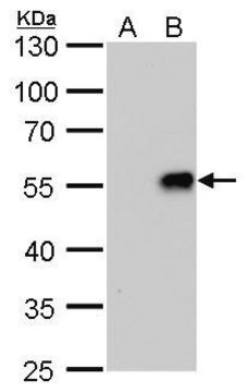 Monoclonal Anti-Influenza A virus H1N1 NA (Neuraminidase) antibody produced in mouse clone GT288, affinity isolated antibody