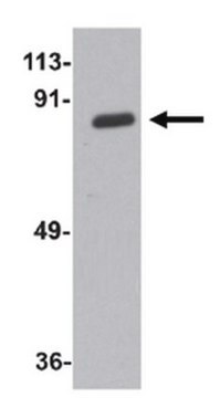 Anti-ZC3H12A Antibody from rabbit, purified by affinity chromatography