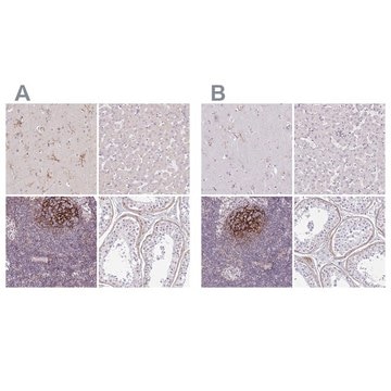 Anti-TMEM119 in Kaninchen hergestellte Antikörper Prestige Antibodies&#174; Powered by Atlas Antibodies, affinity isolated antibody, buffered aqueous glycerol solution