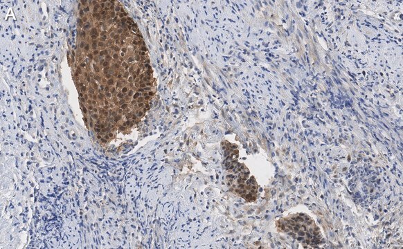 Anti-p16-INK4a Antibody, clone 5F22 Antibody, ZooMAb&#174; Rabbit Monoclonal recombinant, expressed in HEK 293 cells