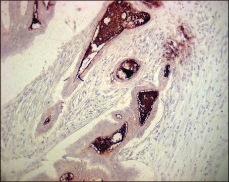 Monoclonal Anti-Carcinoembryonic Antigen antibody produced in mouse clone C6G9, ascites fluid