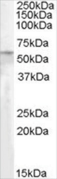 Anti-PNPLA2/ATGL antibody produced in goat affinity isolated antibody, buffered aqueous solution