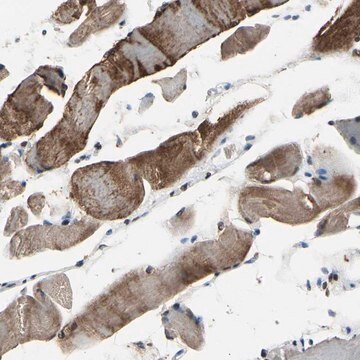 Anti-HIPK2 antibody produced in rabbit Prestige Antibodies&#174; Powered by Atlas Antibodies, affinity isolated antibody, buffered aqueous glycerol solution